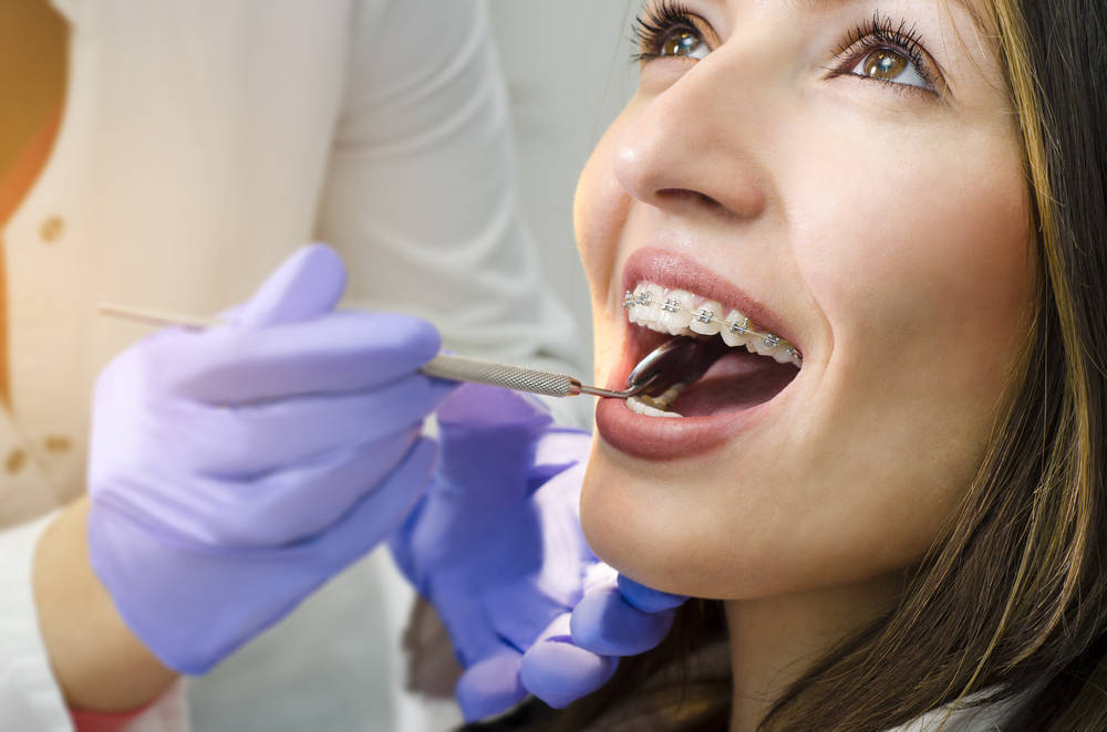 La ortodoncia, una solución buena para la salud dental y bella para la estética