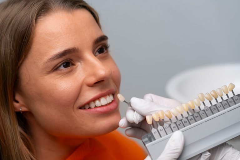 Te cuento cómo es llevar implantes dentales.